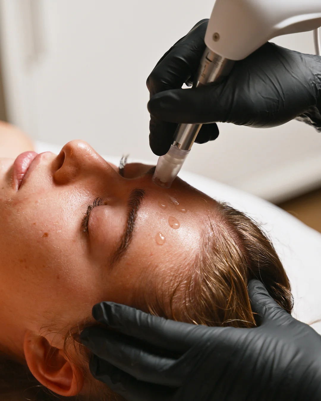 Microneedling treatment at Leela Eco Spa.